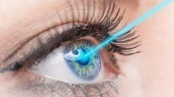 Augenlasern – Die bekanntesten und bewährtesten Verfahren